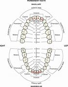 Image result for Lower Lateral Incisors