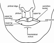 Image result for Warts On Mouth Lips
