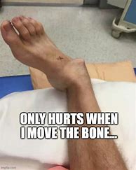 Image result for Ankle Brake Memes