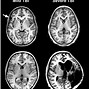 Image result for CT Scan in a Computer Screen Black and White