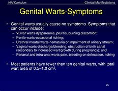 Image result for Male Genital Warts Symptoms