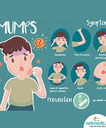 Image result for Mumps