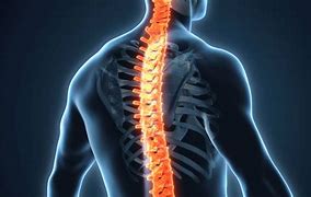 Image result for Cancer of a Fresh Human Spinal Cord