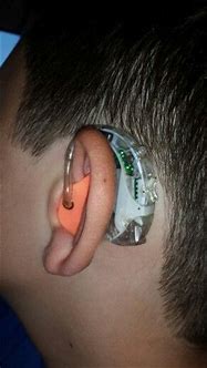 Image result for Latest Hearing Aids