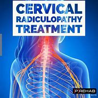 Image result for cervical nerve treatment