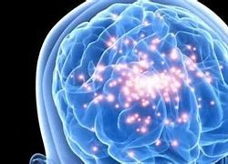 Image result for Collective Memory Implants