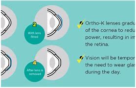 Image result for Green Glass Contact Lenses