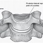 Image result for Cervical Vertebra Lateral View