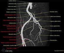 Image result for Angiogram Labeled