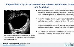 Image result for Management of Adnexal Cyst