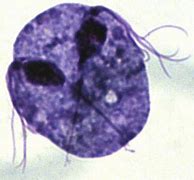 Image result for Trichomonas Under Microscope