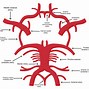 Image result for Carotid Artery Angioplasty