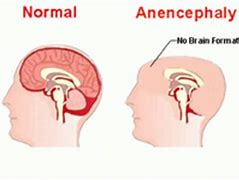 Image result for Neural Tube Anatc