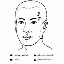 Image result for Acupuncture Face Lift