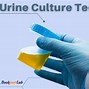 Image result for Urine Culture Process