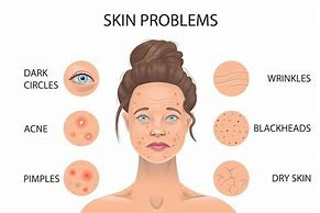 Image result for Types of Skin Tags