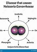 Image result for Gonorrhea Pathogenesis
