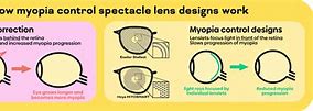 Image result for Myopia Control Glasses