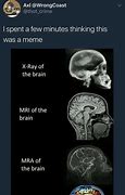 Image result for Brain Scan Meme