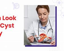 Image result for ovarian cyst surgery