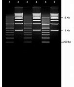 Image result for agarose gels