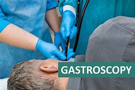 Image result for gastroscopia
