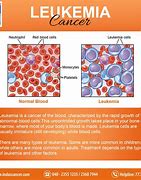 Image result for What Is Leukemia