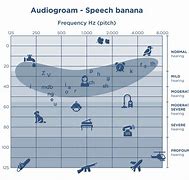 Image result for Audiogram to Boost iPhone Volume