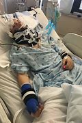 Image result for Severe Head Trauma Patient