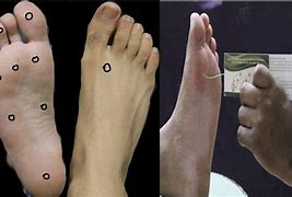 Image result for Foot Circumference