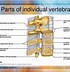Image result for Atlas and Axis Vertebrae