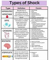 Image result for 4 Types of Shock