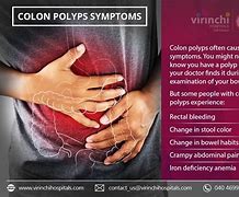 Image result for Apple Core Sign Colorectal Cancer