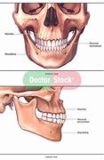 Image result for Bone Jaw French