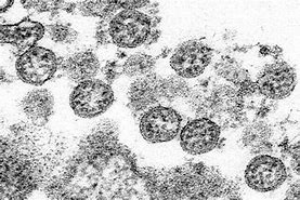 Image result for Covid Virus Images