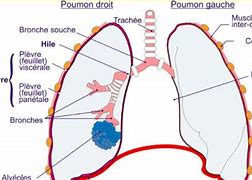 Image result for Hile Du Poumon