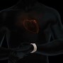 Image result for Ventricular Ectopics On Apple Watch ECG