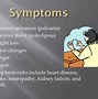 Image result for zdipsia