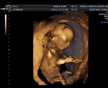 Image result for Baby at 14 Weeks in Womb