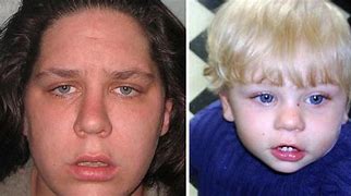 Image result for Baby P's Case