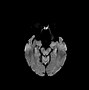 Image result for Amnesia Brain