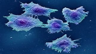 Image result for Colon Cancer Cells