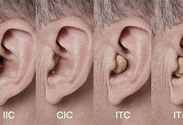 Image result for Invisible in Canal Hearing Aids