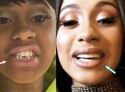 Image result for Cardi B Real Face