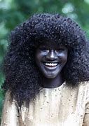 Image result for Why Is My Skin Black