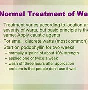 Image result for Female Genital Warts Inside