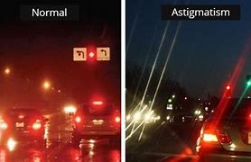 Image result for Eye Astigmatism Driving