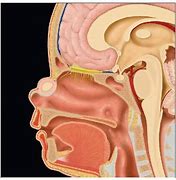 Image result for Gliomas of Nasal Cavity