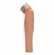 Image result for Above Elbow Prosthesis