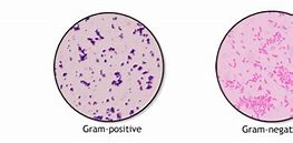 Image result for Mycoplasma Gram Stain